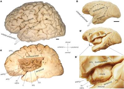 The Organization of the Primate Insular Cortex